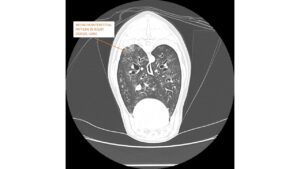 Ct scan of dog with lung worm