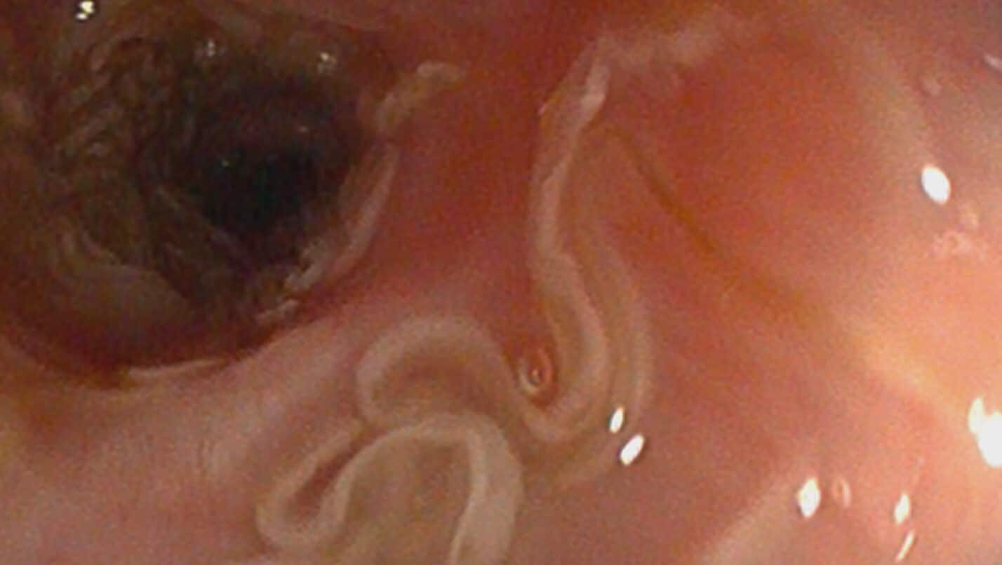 Lung worm