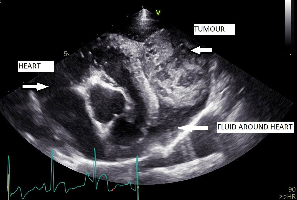 Scan of the fluid and tumour that is on Ace's heart